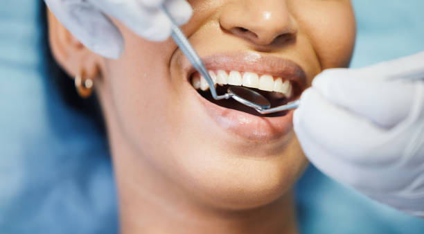 Best Emergency Dental Extractions in Temelec, CA