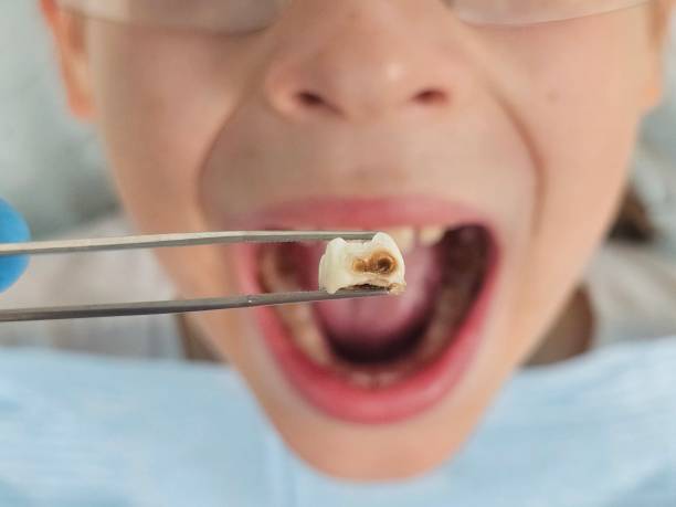 Best Emergency Dental Services for Seniors in Temelec, CA